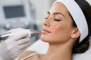 Laser Treatment for Pigmentation: Is It Right?