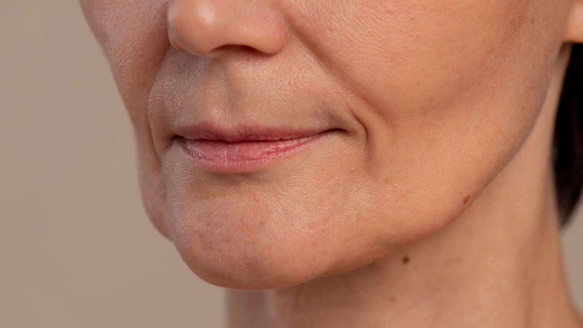 Fine lines and wrinkles consultation