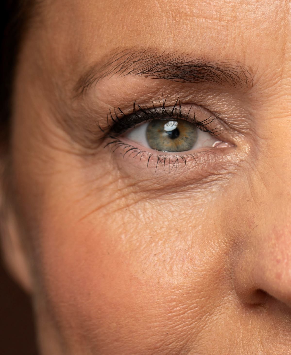 Fine lines and wrinkles consultation