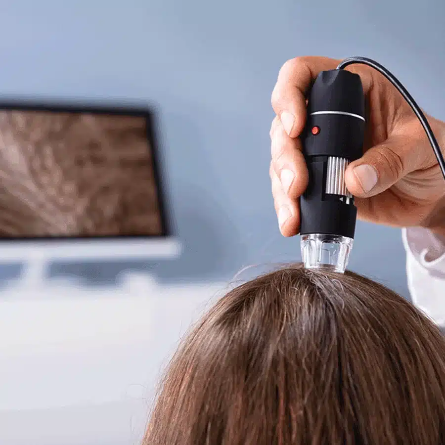 Scalp consultation and assessment at Sky Beauty