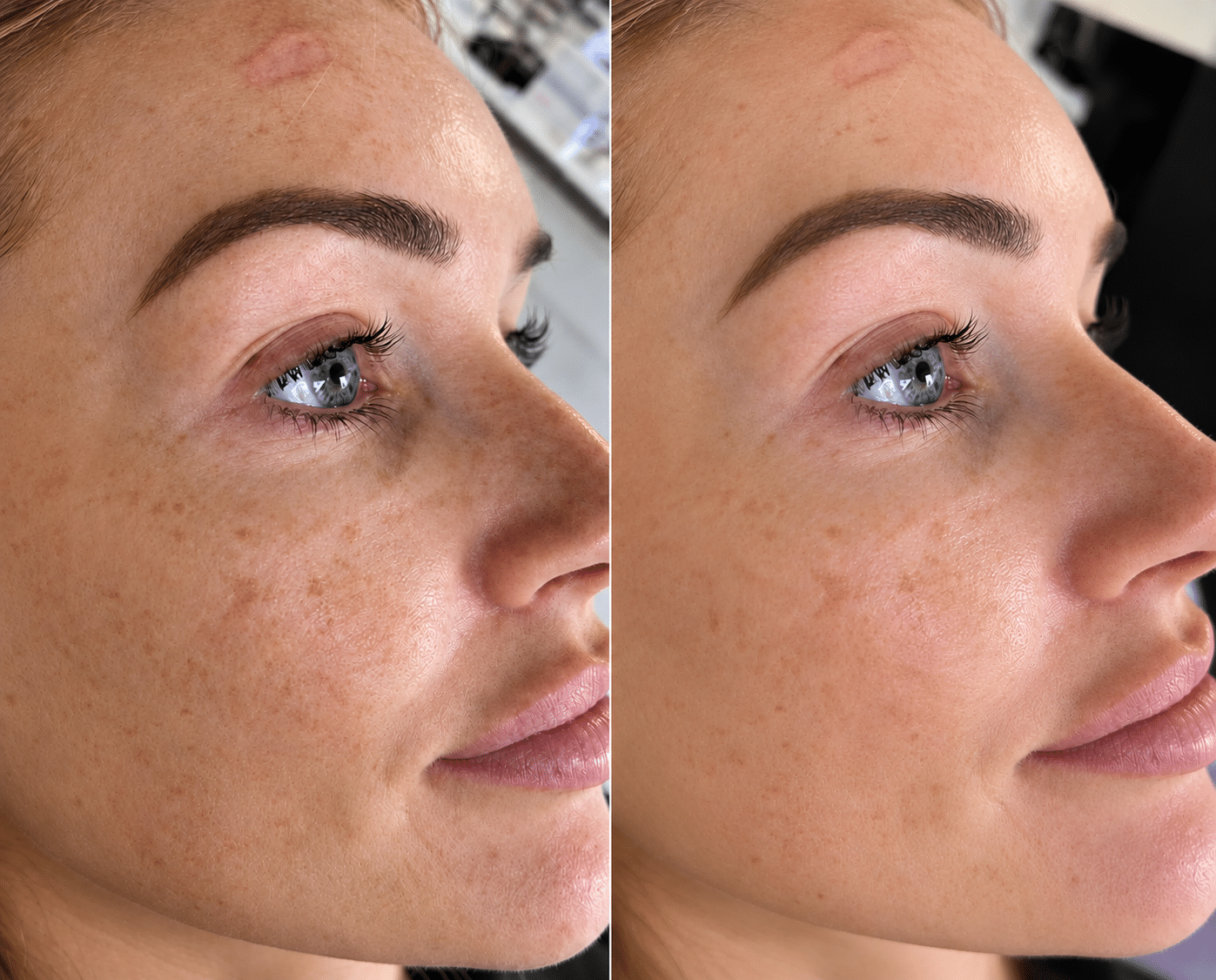 Educational summary of skin hydration and moisturisation